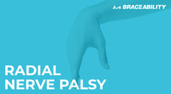 A Guide to Radial Nerve Palsy and Treatment Strategies