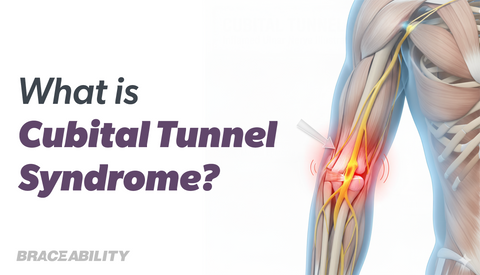 Cubital Tunnel Syndrome: Explore Causes, Symptoms, & Treatment