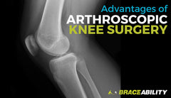 The Advantages of Arthroscopic Knee Surgery