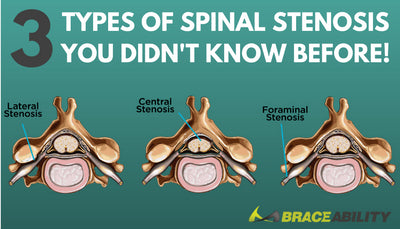The Difference Between Foraminal, Central, & Lateral Recess Stenosis in Your Spinal Cord