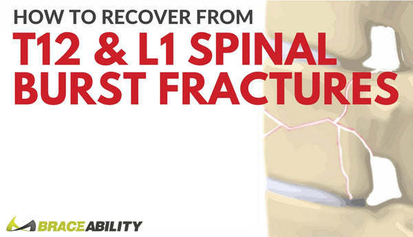 How Can I Treat a T12 or L1 Thoracic Spinal Burst Fracture?