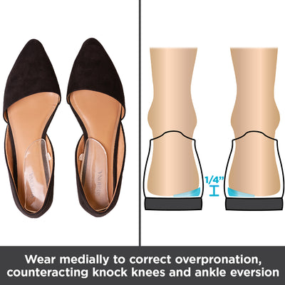 wear these shoe inserts to correct overpronation and counteract knock knees