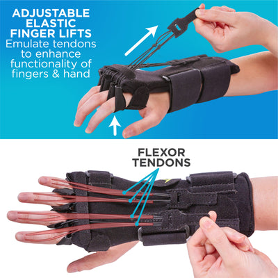 Adjustable elastic finger lifts emulate tendons to enhance functionality from radial nerve palsy