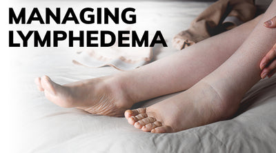 Managing Lymphedema