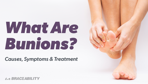 What Are Bunions? Causes, Symptoms & Treatment