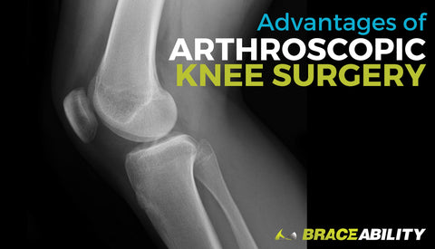 The Advantages of Arthroscopic Knee Surgery