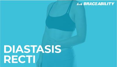 Diastasis Recti (Abdominal Muscle Separation)