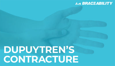All You Need to Know About Dupuytren’s Contracture
