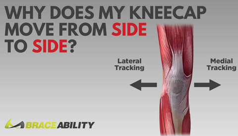 Why Your Kneecap Moves from Side to Side: Patella Instability & Dislocation Explained