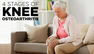 4 Stages of Knee Osteoarthritis