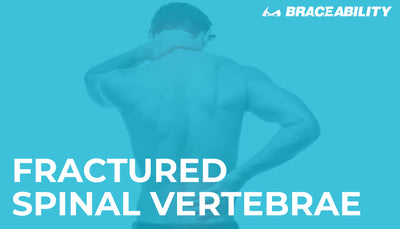 Fractured Spinal Vertebrae