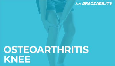Osteoarthritis of the Knee | Symptoms, Causes, Treatments & Exercises