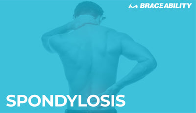 Spondylosis