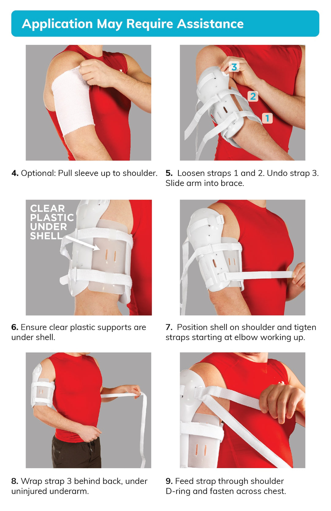 Code For Coaption Splint Coaptation Splint For Humerus Fracture
