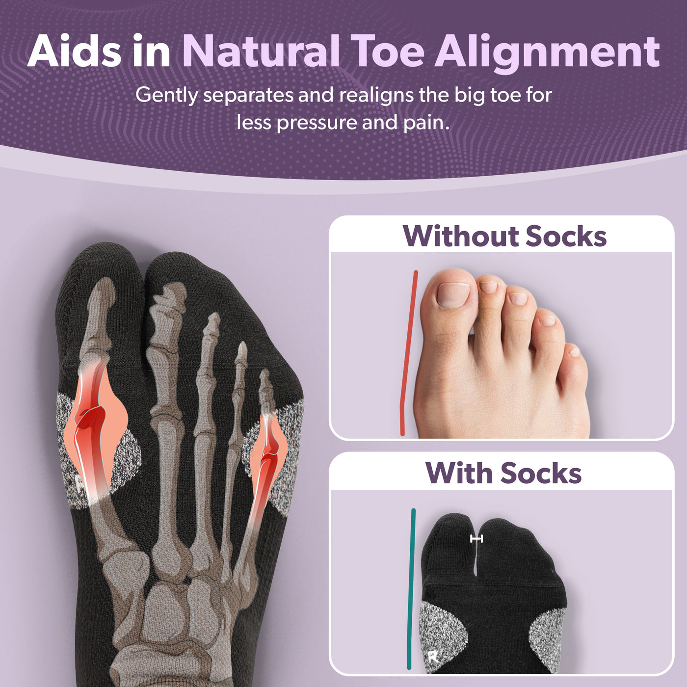 Illustration of bunion toe separators for women and men on a purple background, showing targeted bunion pain relief benefits.