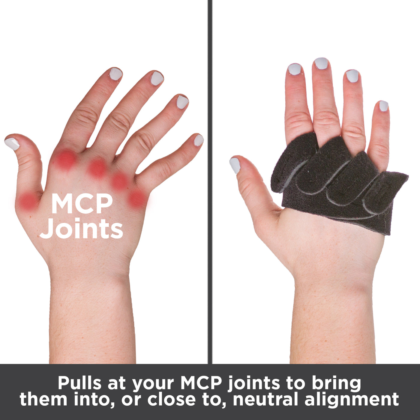 Pulls at your MCP joints to bring them into, or close to, neutral finger alignment