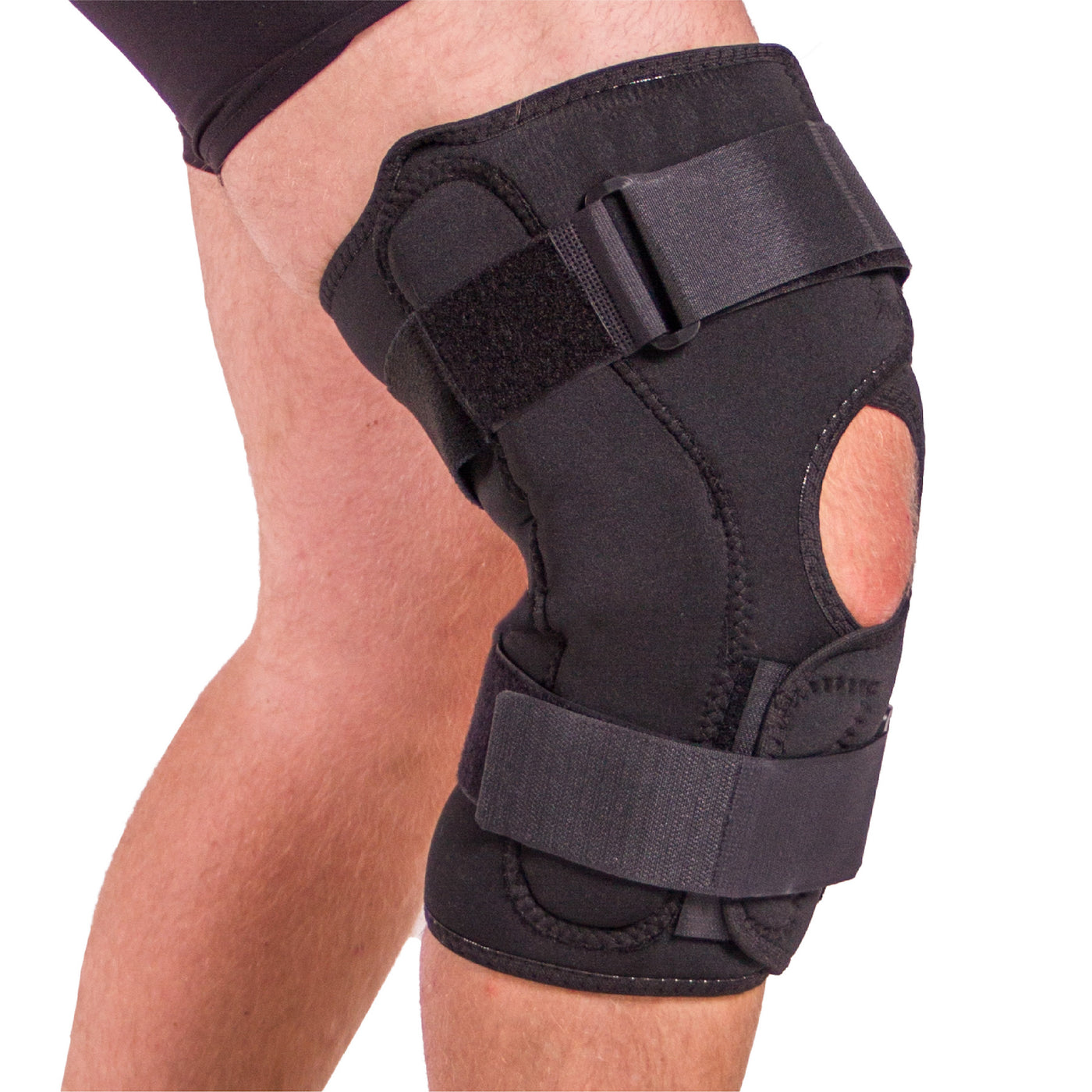 Two days after surgery, the patient wore an adjustable knee brace of