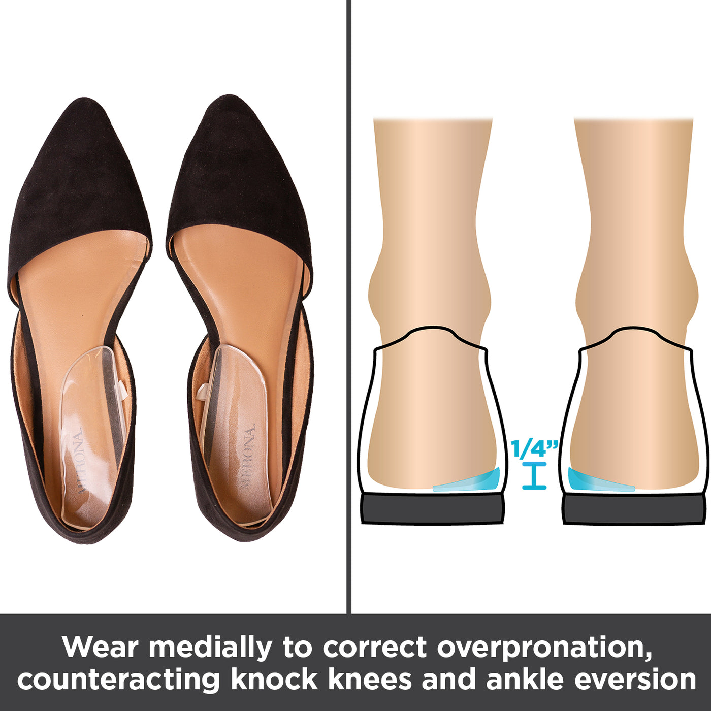 Medial & Lateral Heel Wedge Inserts | Varus / Valgus Insoles for Shoes