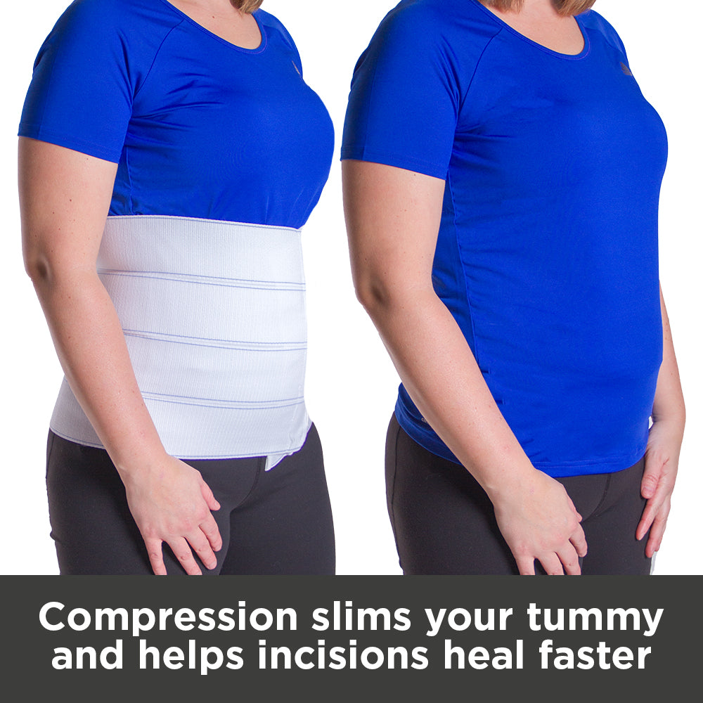 Abdominal Support to Help Recover After Weight Loss Surgery