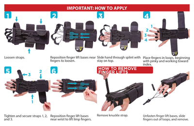 Instruction sheet for how to apply a radial nerve palsy brace