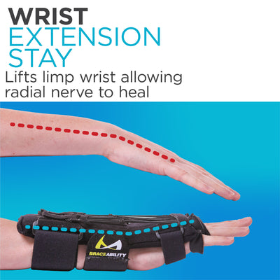 Built in hard plastic extension stay lifts limp wrist allowing radial nerve to heal